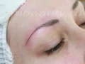 ����