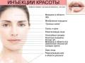 Ботулинотерапия.