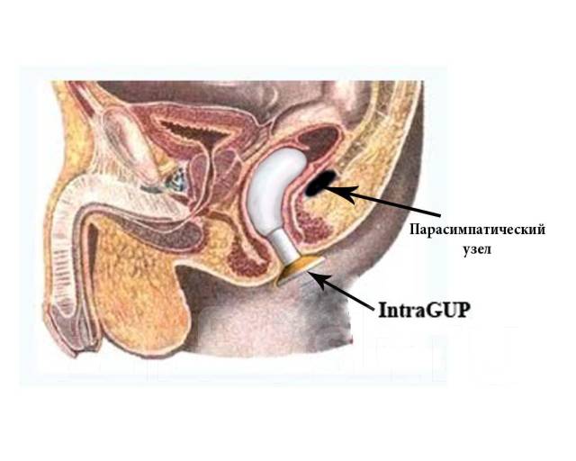 Clash of Titans порно видео