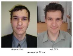 Работа с мышцами лица! Безопасный ферментативный пилинг !