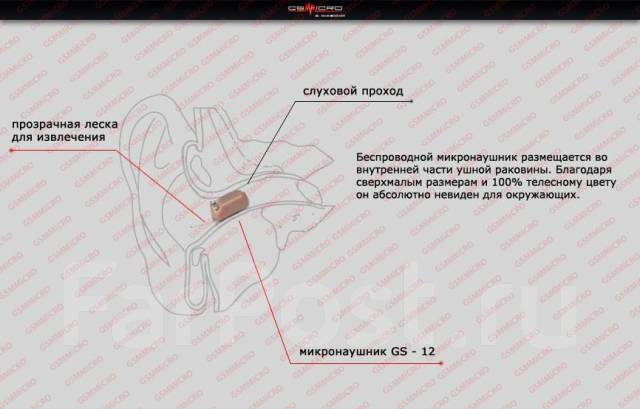 Как достать микронаушник из уха. GS-12 Series микронаушник. Извлечение микронаушника. Микронаушник для слухи. Микронаушник для экзамена как вставлять.