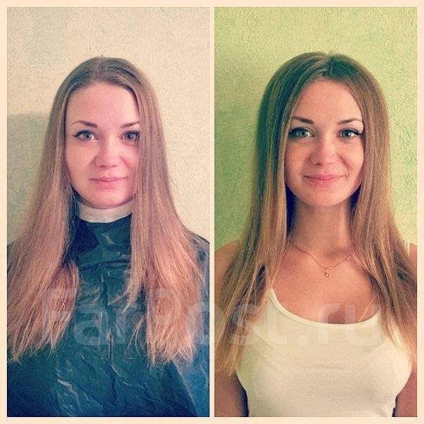 Буст ап до и после отзывы Boost UP. Прикорневой объем на 6 месяцев в Уссурийске