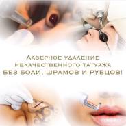 Удаление татуировок.