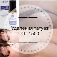 Удаление татуировок.