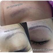Микроблейдинг (микропигментирование) бровей