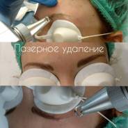 Удаление перманентного макияжа