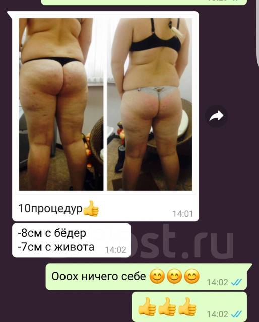 LPG-. 