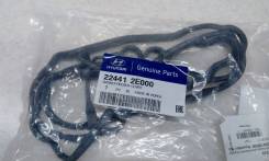 Прокладка клапанной крышки. Hyundai: ix35, i40, i30, Sonata, Elantra, Creta, Tucson, Avante Kia: Optima, Cerato, Sportage, Forte, K3, Soul, K5, Carens