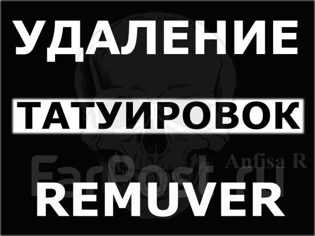 Удаление перманентного макияжа и татуировок плазмой и ремувером в Артеме