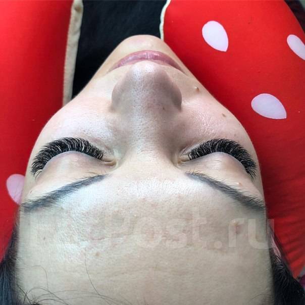   -. 