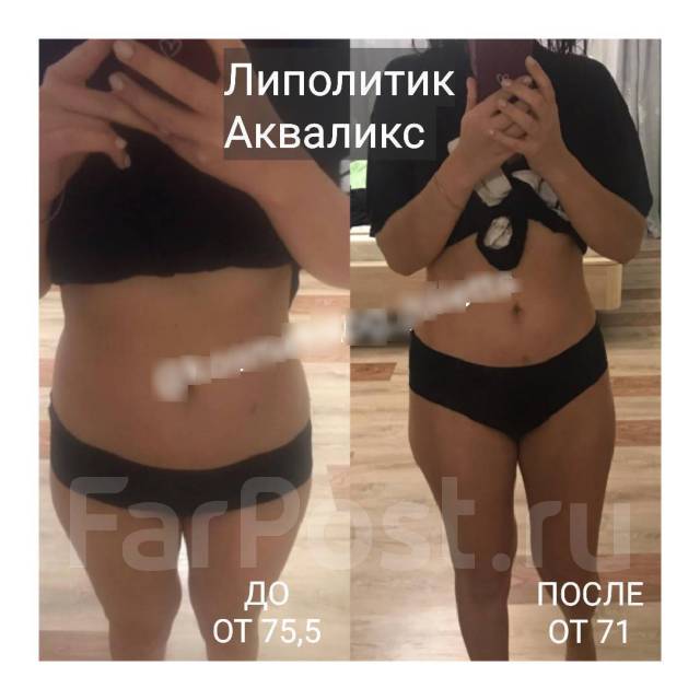Акваликс отзывы фото до и после цена Лучшие липолитики для красоты тела и лица! Убираем жирок! Акваликс во Владивосто