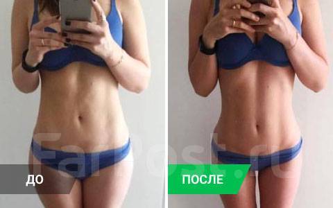 Фото результата от миостимулятора EMS Фитнес в Артеме