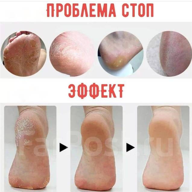 Смарт педикюр картинки