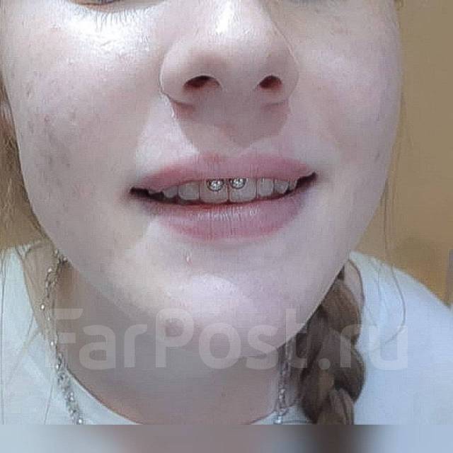,  . 