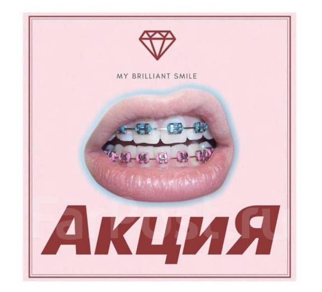 Косметическое отбеливание зубов My Brilliant Smile - Косметология и ...