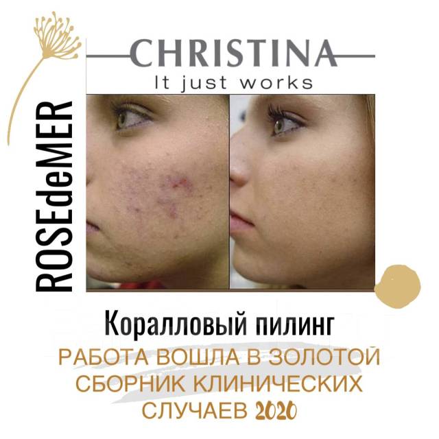 Коралловый пилинг (Rose De Mer) от Christina