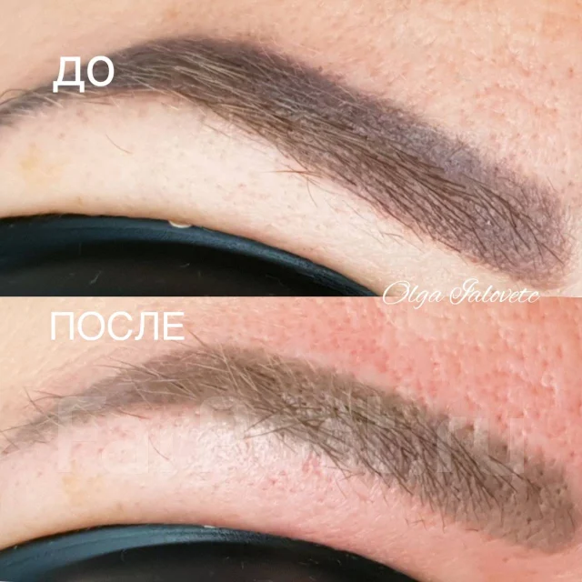 Удаление Татуажа, Лазер, Ремувер, р-он Столетие во Владивостоке