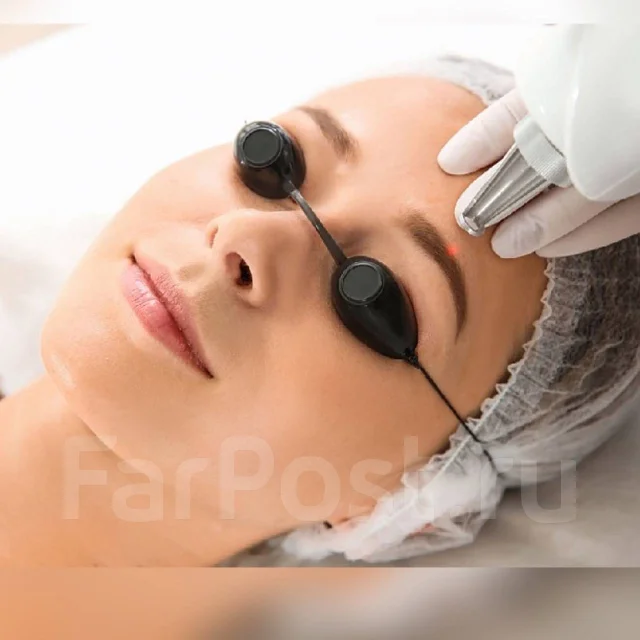 Удаление Татуажа, Лазер, Ремувер, р-он Столетие во Владивостоке