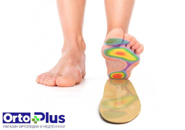 Изготовление! Индивидуальные ортопедические стельки Pedag (Германия ...