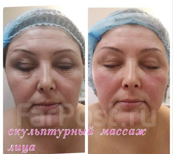 Скульптурный массаж лица до и после