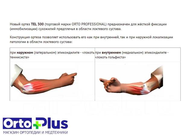 Бандаж на локтевой сустав Orto Professional TEL 300, новый, в наличии ...