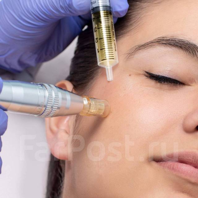 Мезотерапия (ФМ) лицо и шея \"Янтарное омоложение\" во Владивостоке