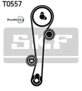 �������� ����� ��� Hyundai Accent/Elantra/GETZ 1.6/1.5 SKF VKMA95632 VKMA95632 ����