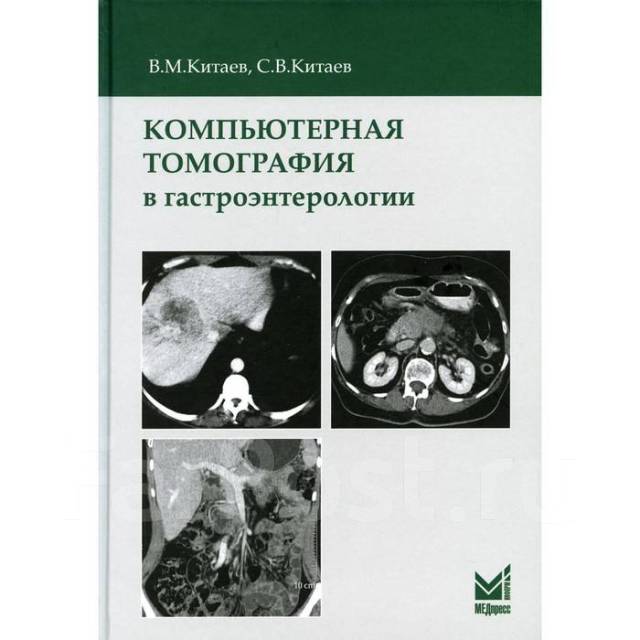 М китаев. В М Китаев кт в гастроэнтерологии. Прокоп компьютерная томография. Книги по кт диагностике. Рентгенология и компьютерная томография книга.