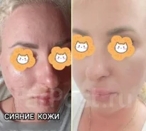 �������� ������� � ��������� � ������������ �������� �� 3500 ������ ����