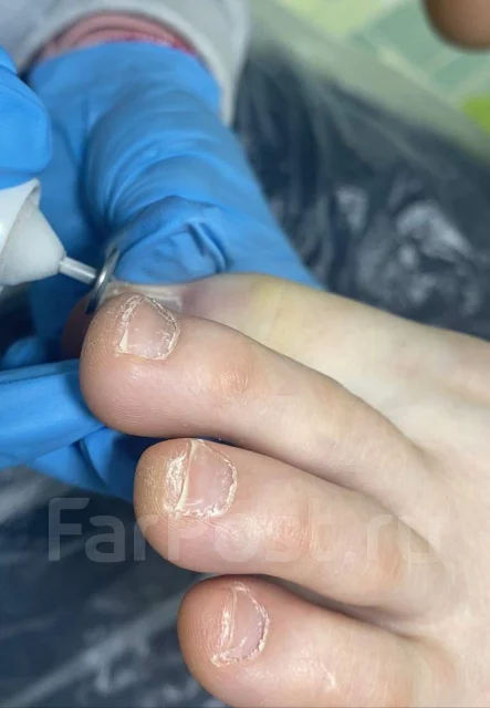 ������ ��������. �� ������ ( ������ � �����. ����� ������� 55� ����