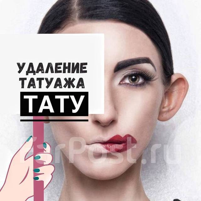 Удаление ТАТУ | Татуажа | Карбоновый Пилинг во Владивостоке