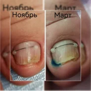 �������. ����