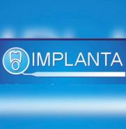 , . "". implanta.    