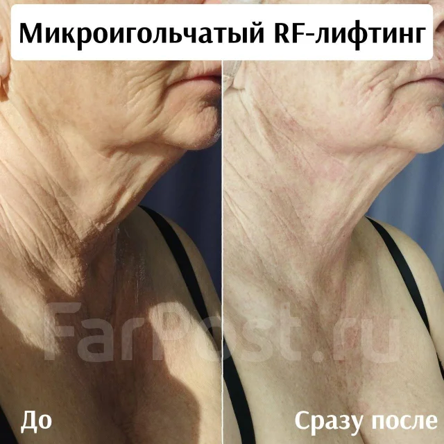 RF-�������. ����