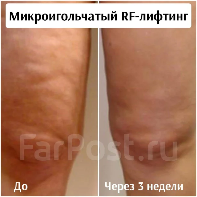 RF-�������. ����