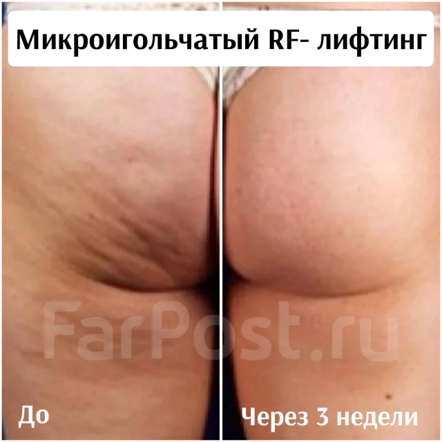 RF-�������. ����