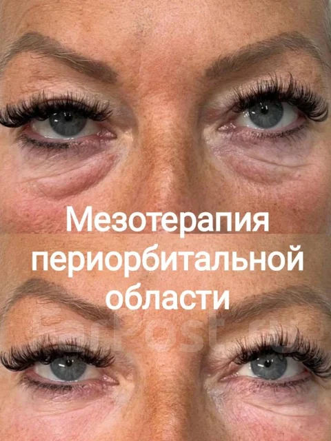 ������������. ����