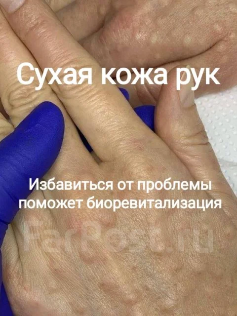 ������������. ����