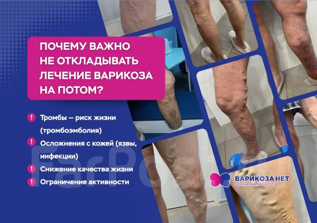 �������� �������� �� ����� ������� ����