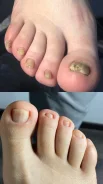 �������. ����