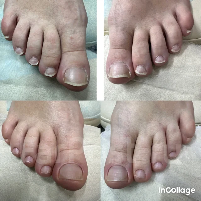 ������� ������� ����