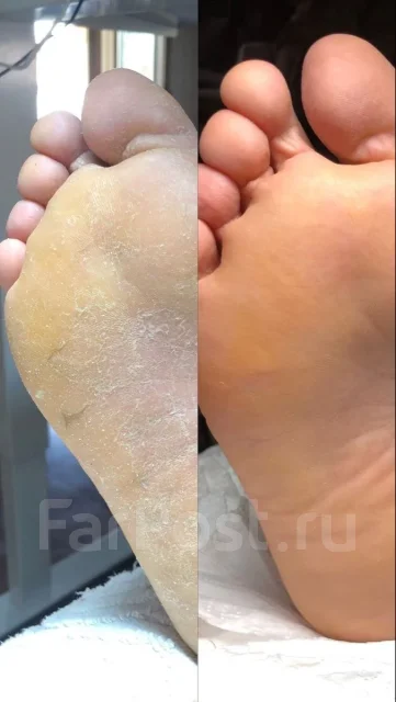 ������� ������� ����