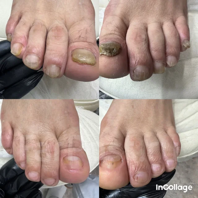 ������� ������� ����