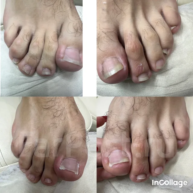 ������� ������� ����