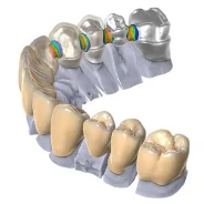 ������ ������. �� ������ ����������������� ������� Dental Crown. ����� ������� 6 ����