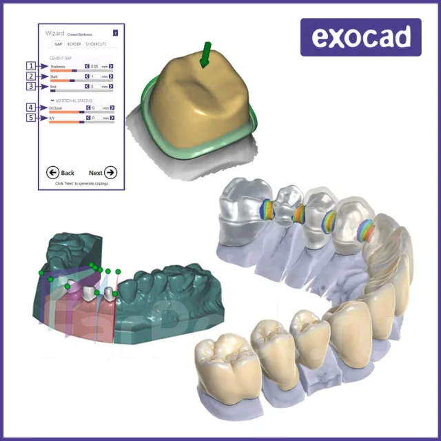 ������ ������. �� ������ ����������������� ������� Dental Crown. ����� ������� 6 ����